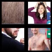 4 Pics 1 Word 8 Letters Answers Dandruff