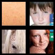 4 Pics 1 Word 8 Letters Answers Freckles